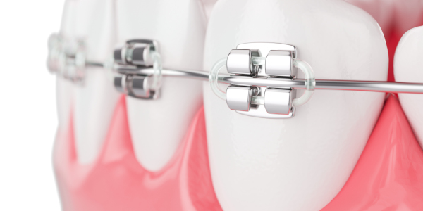 Principe de l'orthodontie