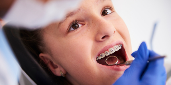 Orthodontie par aligneurs