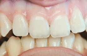 Cas cliniques d'orthodontie