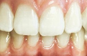 Cas cliniques d'orthodontie