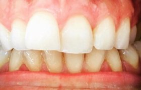 Cas cliniques d'orthodontie