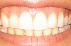 Cas cliniques d'orthodontie